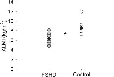 Sarcopenic Obesity in Facioscapulohumeral Muscular Dystrophy
